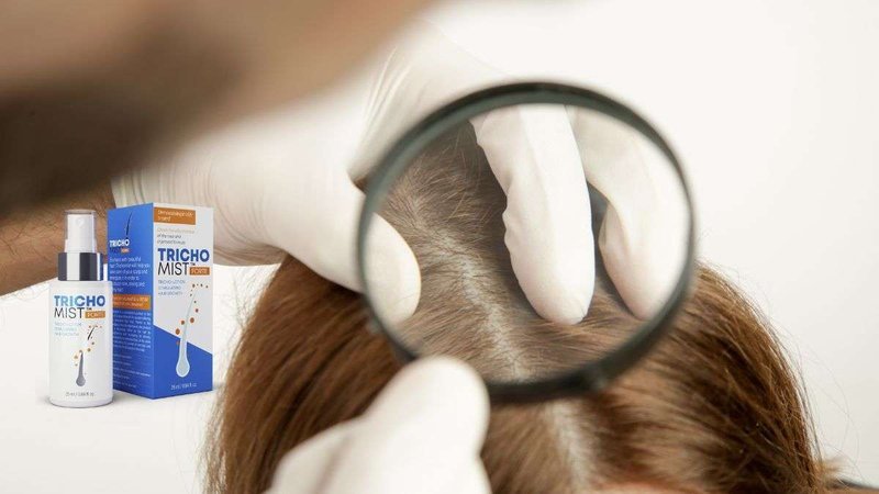 Introduction to trichomist forte jak działa